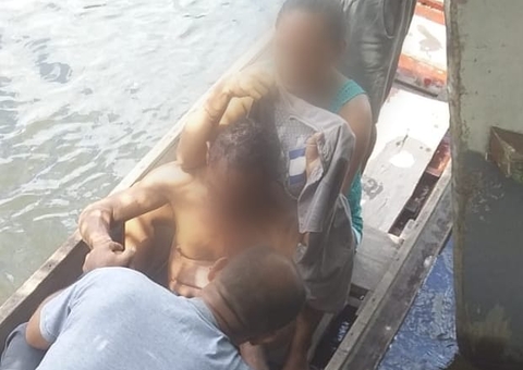 Idoso tem ossos do rosto amassados e fica sem olho durante ataque de onça