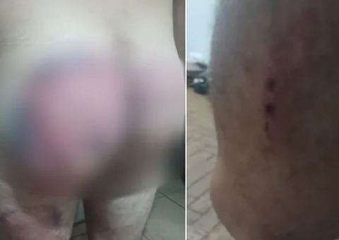 Exército expulsa seis militares envolvidos em agressão a soldado no quartel