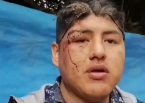 Homem acorda dentro de caixão após ser oferecido em ritual