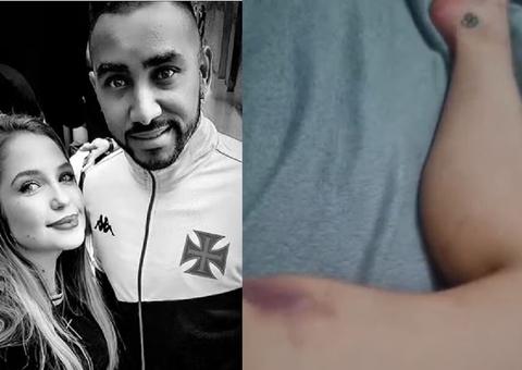 Suposta amante acusa Dimitri Payet, do Vasco, de agressão e humilhações  