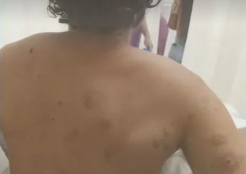 Brasileiro fica ferido e outros dois desaparecem durante ataque a Israel