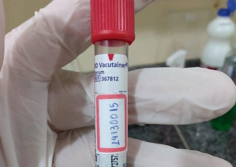 Pesquisadores do Amazonas desenvolvem app que ajuda no diagnóstico de doenças febris