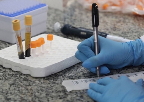 Estudo descarta relação entre tipo sanguíneo e mais chances de ter covid-19