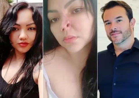 Dentista é indiciado depois de paciente perder parte do nariz após procedimento estético