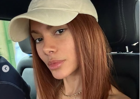 Equipe de Anitta nega ter detalhado procedimentos estéticos da cantora 