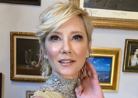 Anne Heche ficou presa em carro em chamas por 45 minutos antes de resgate