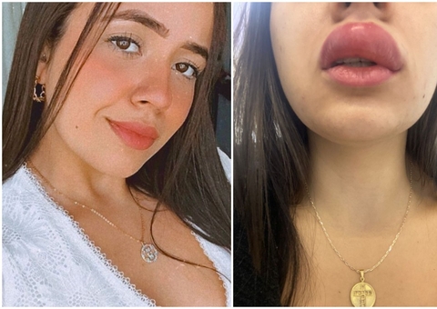 Mulher tem boca deformada após ser picada enquanto dormia