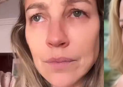 Luana Piovani faz cirurgia plástica e mostra resultado: 'recauchutagem feita'