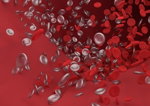 Risco de trombose aumenta após trauma ou cirurgia; entenda