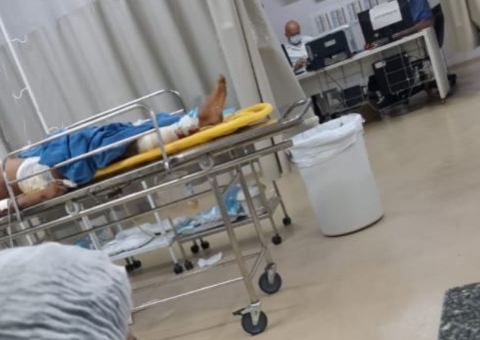 Adolescente tem pé decepado após atirar em mulher durante assalto no Amazonas