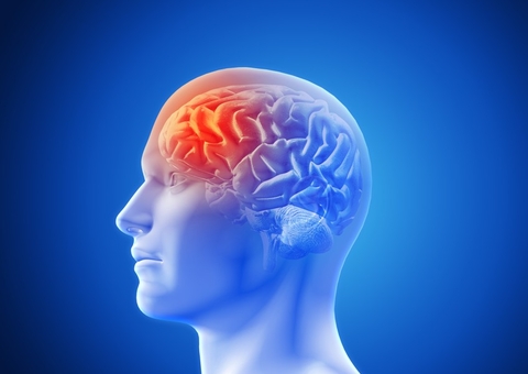 AVC mata 1 brasileiro a cada 6 minutos; saiba como evitar