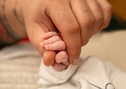 Mulher dá luz à gêmeas siamesas com três braços 
