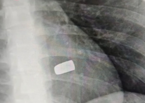 Jovem morre ao ser crivado de tiros no meio da rua em Manacapuru