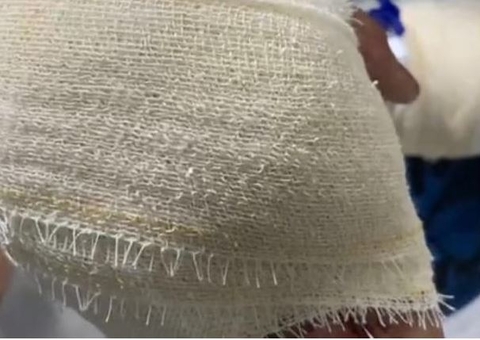 Jovem leva tiro na mão por demorar a entregar celular durante assalto em Manaus