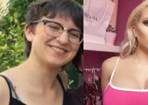 Jovem gasta R$ 180 mil em plásticas para ficar parecida com a Barbie