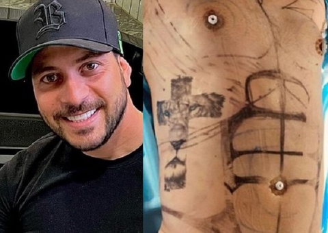 Ex-BBB Caio Afiune faz recauchutagem com lipo lad e fica sarado; veja o resultado