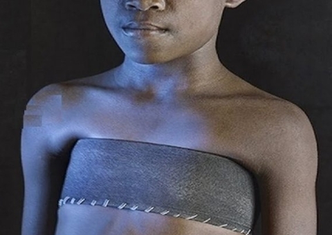 Meninas africanas sofrem torturas nos seios para evitar atração masculina