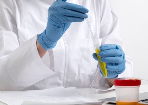 Farmácias começam a ofertar exames de análises clínicas, veja lista  