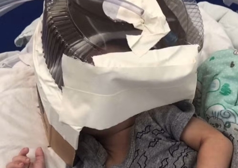 Morre bebê que usou máscara de oxigênio improvisada com embalagem de bolo
