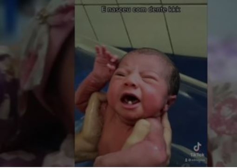 Bebê surpreende ao nascer com 2 dentes no Pará