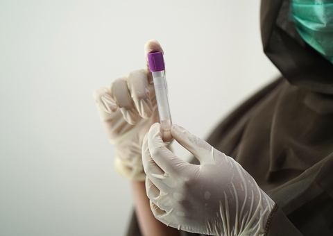 Amazonas tem 1.651 casos e 61 óbitos por vírus respiratórios