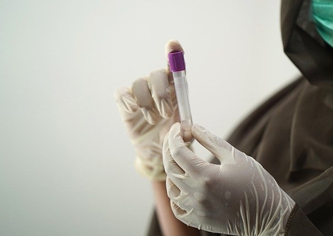 DPE pede providências para evitar novo colapso na saúde no interior do Amazonas