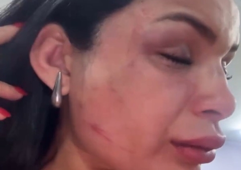 Passageira afirma ter sido agredida por motociclista de app durante corrida em Manaus