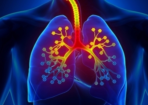 Bronquite: cuidados necessários para evitar as crises