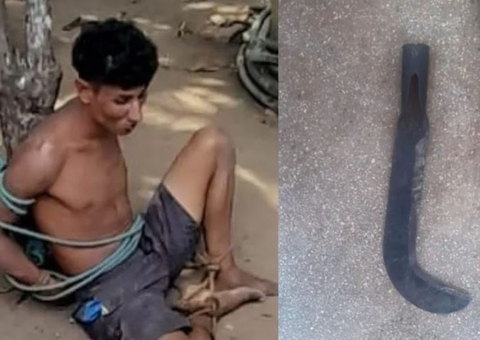 Homem "surta" e decepa mão de idoso com foice