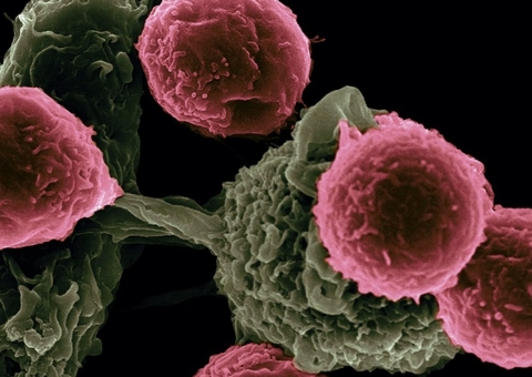 É possível reduzir fatores de risco do câncer? Veja 12 formas de se prevenir