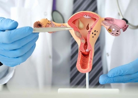 Amazonas estima 610 novos casos de câncer de colo de útero para 2024; saiba como se prevenir