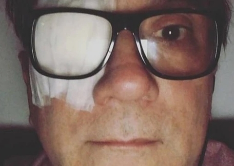 Vocalista do Biquíni Cavadão faz cirurgia para retirar tumor maligno