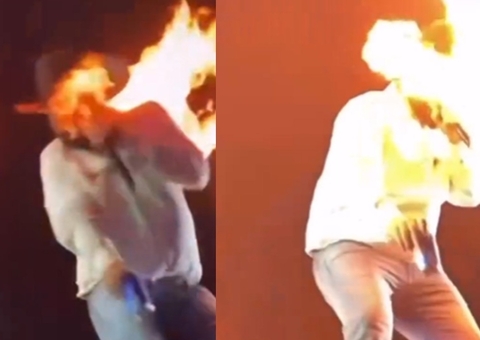 Cantor sofre queimadura no rosto durante show; vídeo
