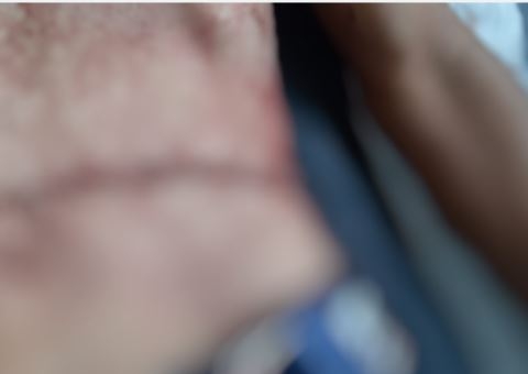 Jovem morre com vísceras arrancadas durante bloco de carnaval no Amazonas