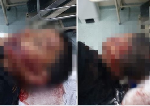 Menino autista é levado para matagal e brutalmente espancado