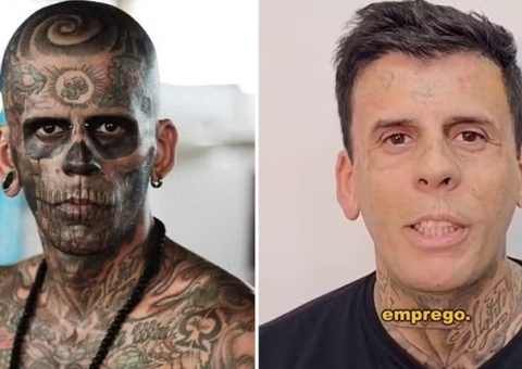 'Mais tatuado do Brasil' surge irreconhecível após sessão de laser