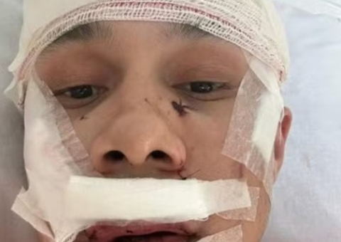 Morador do DF confessa agressão a personal trainer em bar de SP