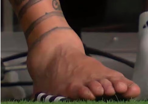 Vídeo mostra momento exato da lesão que tirou Messi do final da Copa América