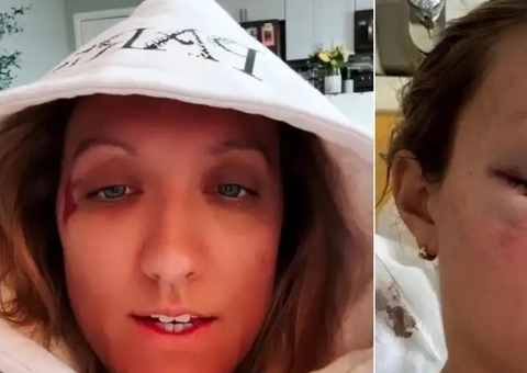 Atletas do vôlei feminino dos EUA sofrem acidente de carro em Paris