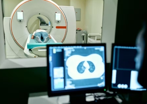 Pacientes do SUS esperam até 75 dias para começar tratamento de câncer