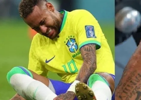 Neymar mostra cicatrizes após cirurgias e um ano sem jogar; 'Guerreiro'