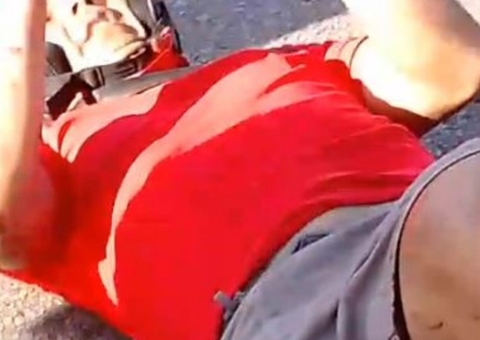 Homem sofre acidente grave e tem perna dilacerada em Manaus