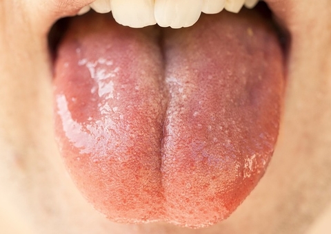 Especialista faz alerta do perigo de transmissão do coronavírus pela saliva