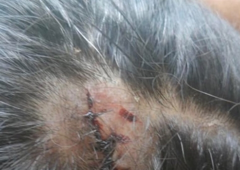 Funcionária de hotel é agredida com banco de madeira por hóspede no AM 