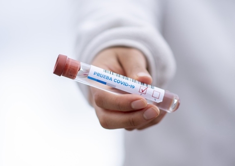 Soro contra covid-19 do Butantan será testado em humanos em abril