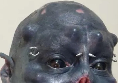 'Caveira' corta o nariz e choca com transformação; Veja antes e depois