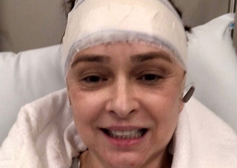 Myrian Rios passa por cirurgia de 4 horas na cabeça 