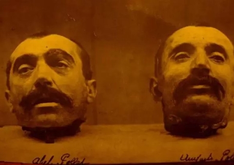 No século 18 pessoas acreditavam que cabeças decepadas expressavam raiva