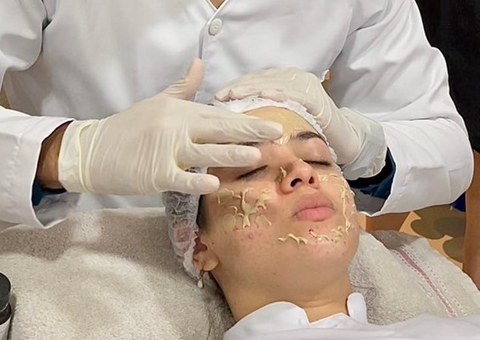 Receitas caseiras para esfoliar a pele devem ser usadas com cautela, alerta especialista