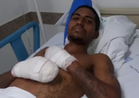 Ciclista em Araçatuba não viu bomba e entrou em desespero ao olhar para pernas 